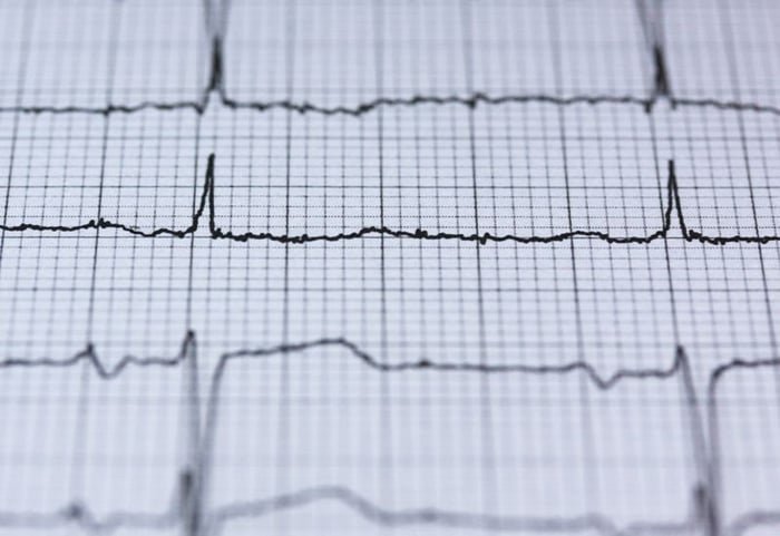 ECG hỗ trợ các chuyên gia trong việc chẩn đoán các vấn đề liên quan đến tim mạch