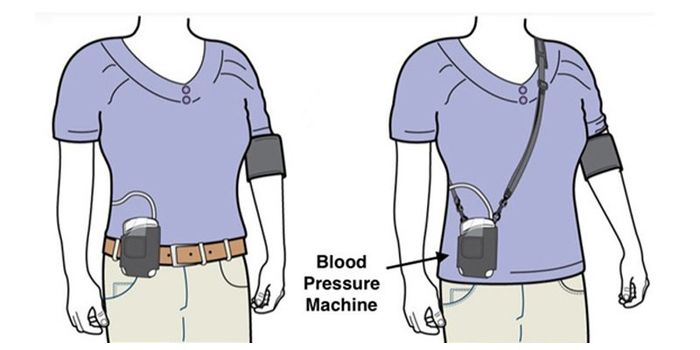 Holter điện tâm đồ được đánh giá là phương pháp hiệu quả và an toàn bởi các chuyên gia Tim mạch 