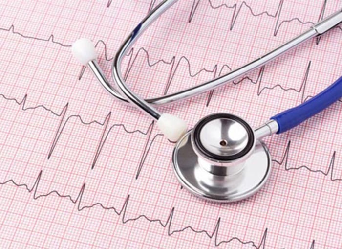 Phương pháp ECG được sử dụng để chẩn đoán tình trạng thiếu máu cơ tim.