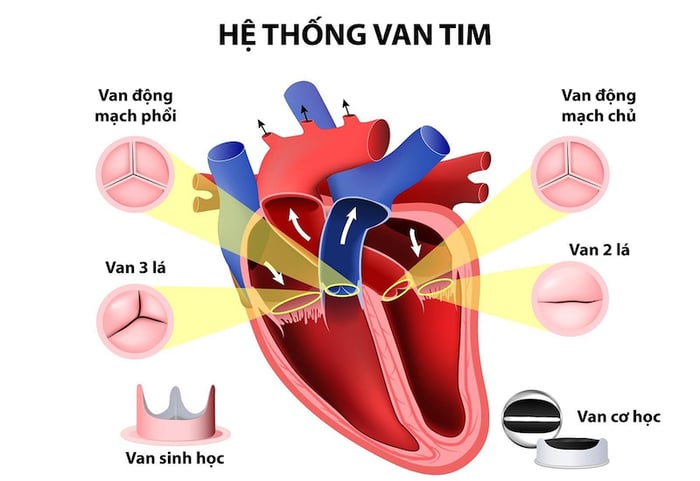 Khi nào cần thay đổi van tim