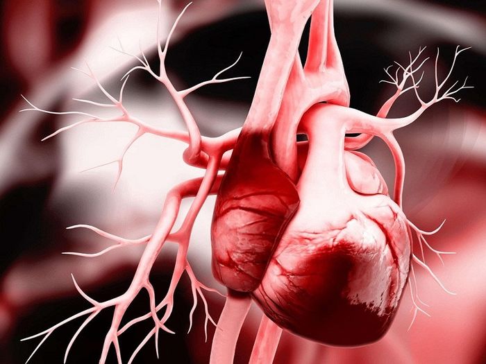 Thiếu máu ở một phần của cơ tim có rủi ro lớn