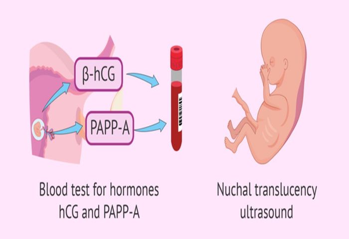 Xét nghiệm Triple Test có thể đánh giá nguy cơ dị tật của thai nhi.