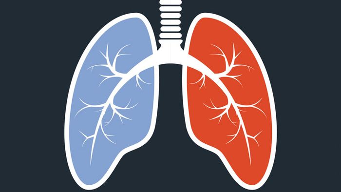 Pulmonary heart disease often has a severe prognosis