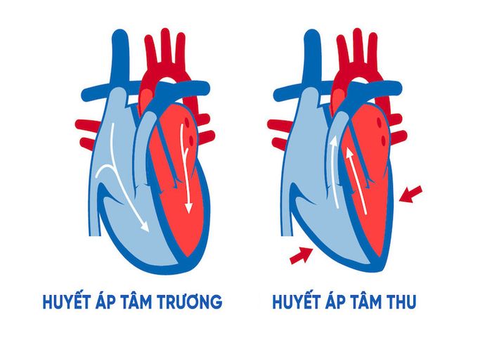 Mô phỏng về huyết áp tâm trương và huyết áp tâm thu