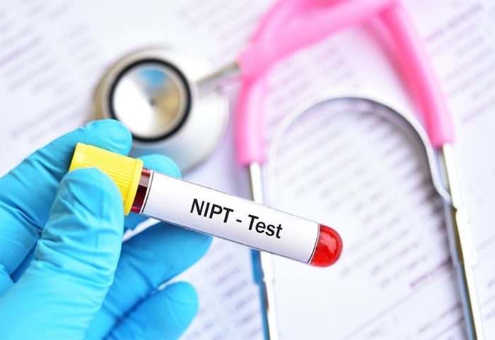 Xét nghiệm NIPT được đánh giá có nhiều ưu điểm vượt trội