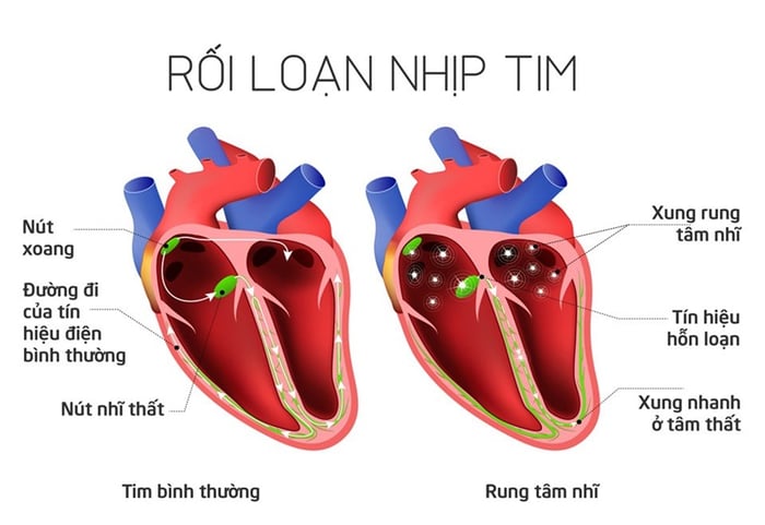 Máy được áp dụng trong những trường hợp gặp phải rối loạn nhịp tim