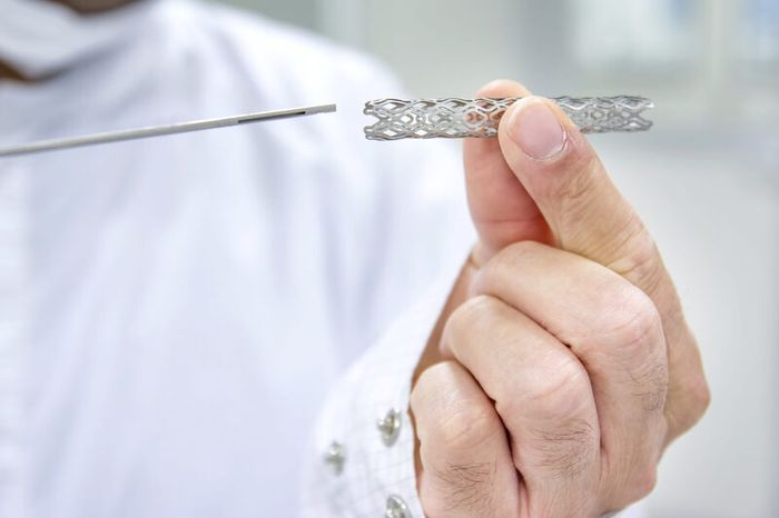 Khi nào cần đặt Stent Graft?