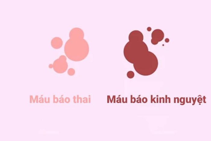 Máu báo thai và chu kỳ kinh nguyệt có nhiều điểm tương đồng nên dễ bị nhầm lẫn