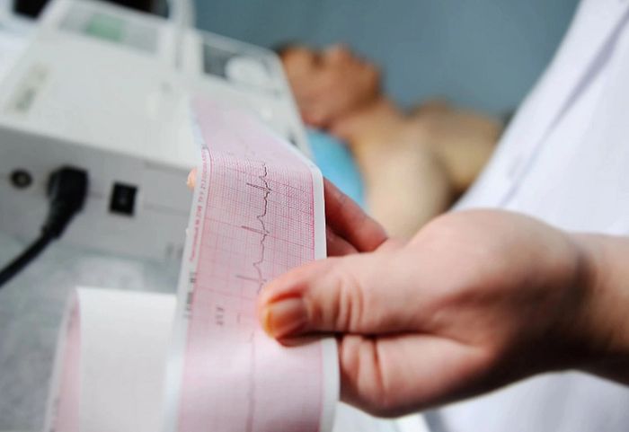 Kiểm tra sức khỏe khi trạng thái rối loạn nhịp tim kéo dài