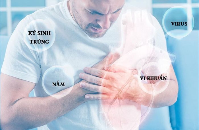 Viêm cơ tim là kết quả của sự xâm nhập của virus.