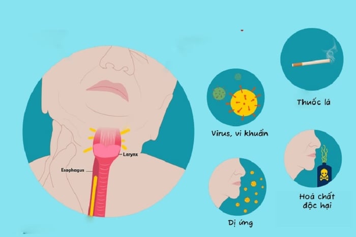 Một số nguyên nhân phổ biến gây ra tình trạng đau họng