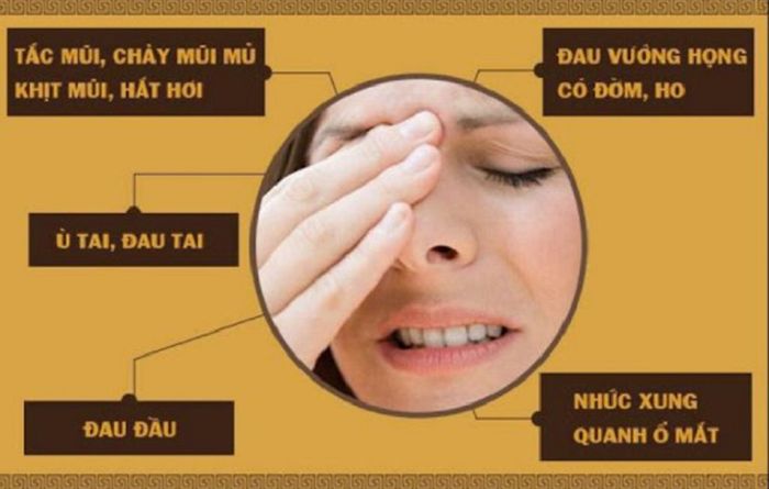 Triệu chứng cảnh báo bệnh nặng cần đi khám viêm xoang ngay