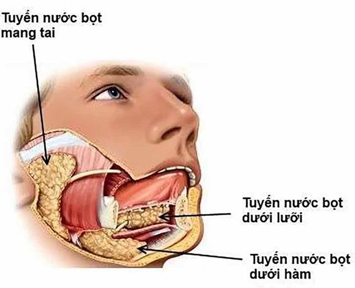 Các vị trí dễ phát triển sỏi tuyến nước bọt