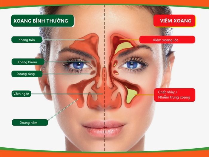 Tìm hiểu về vị trí của xoang sphenoid