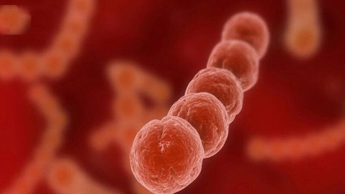 Viêm họng liên cầu do vi khuẩn Streptococcus gây ra