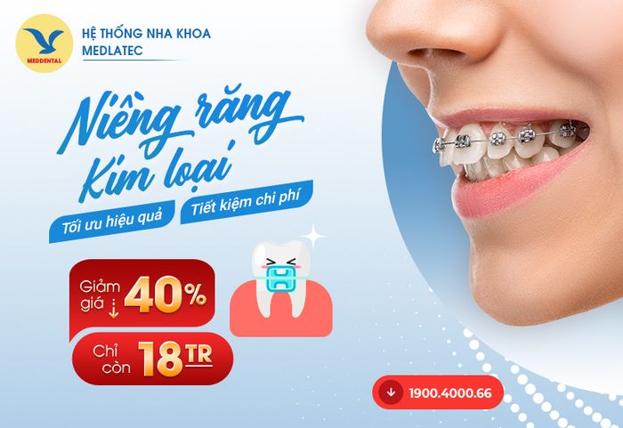 Khách hàng có thể yên tâm niềng răng tại MedDental