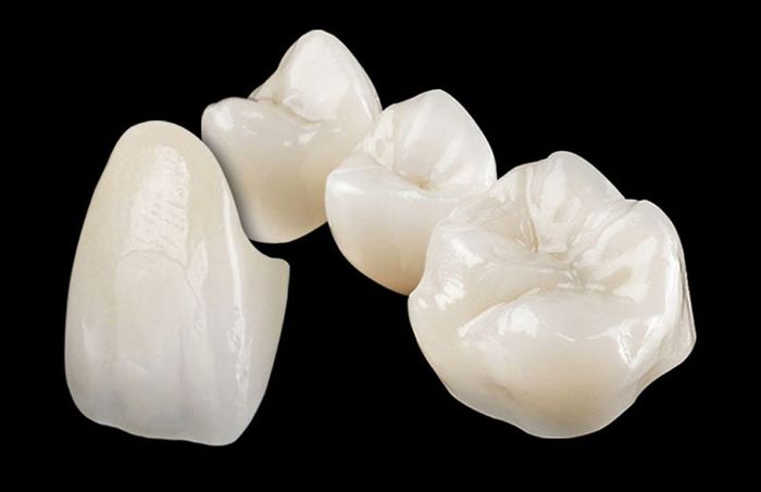 Dòng răng sứ Zirconia có độ bền cao