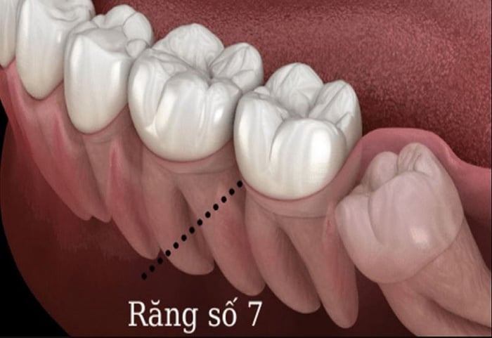 Răng thứ 7 đóng vai trò quan trọng trong việc tiêu hóa thức ăn và tạo hình khuôn mặt đẹp.