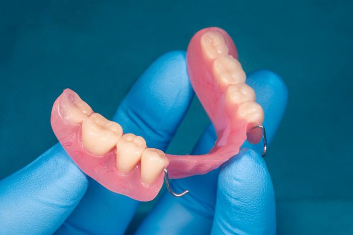 Mức chi phí làm răng giả tháo lắp cho một chiếc tùy thuộc vào chất liệu làm răng.