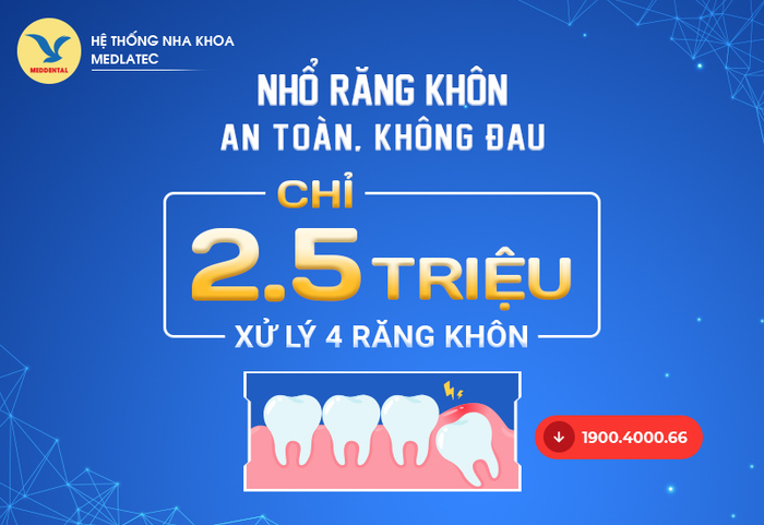 Hệ thống Nha khoa MEDDENTAL áp dụng phương pháp nhổ răng hiện đại giúp giảm thiểu đau đớn, chảy máu và đảm bảo an toàn cao