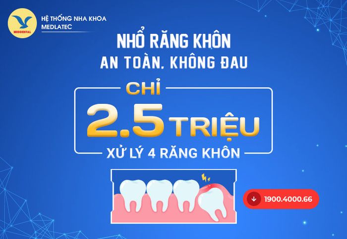 Chương trình ưu đãi nhổ răng khôn tại MEDDENTAL