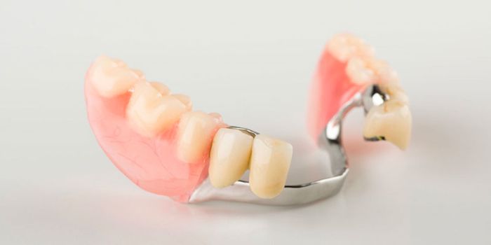 Đa Dạng Các Loại Hàm Giả Tháo Lắp