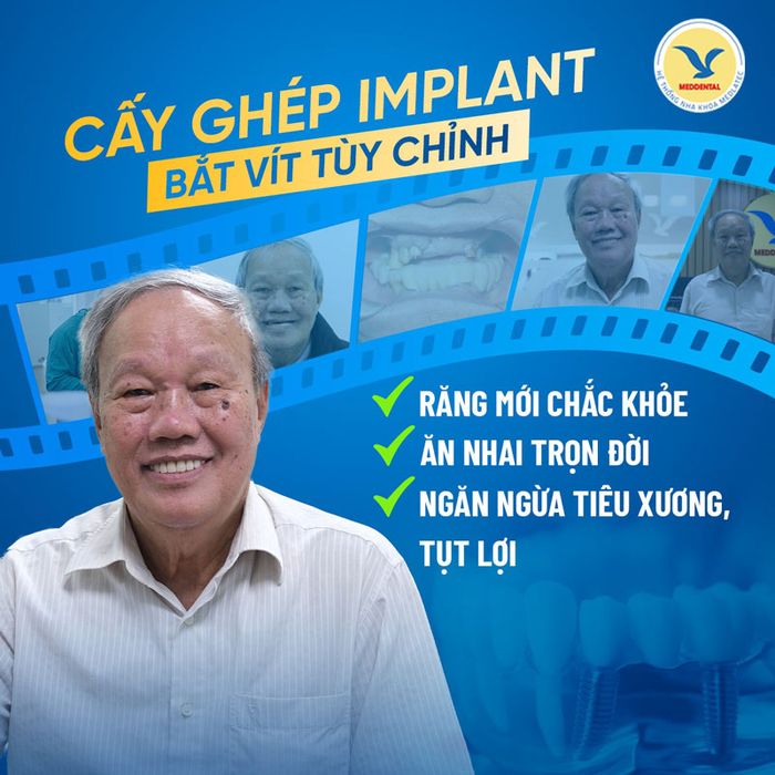 Phương pháp cấy ghép Implant giải quyết nhiều vấn đề về răng miệng