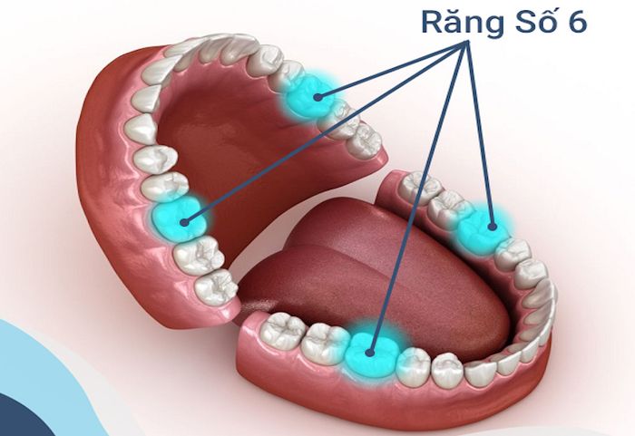 Vị trí của răng thứ 6