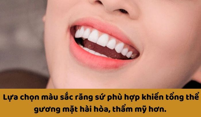 Lựa chọn màu sắc phù hợp cho răng sứ giúp nụ cười của bạn trở nên tươi sáng hơn