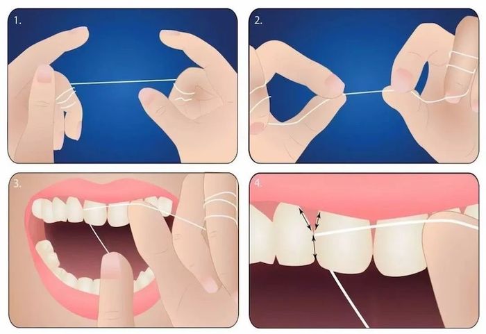 Trước khi đánh răng, hãy sử dụng chỉ nha khoa để làm sạch răng.