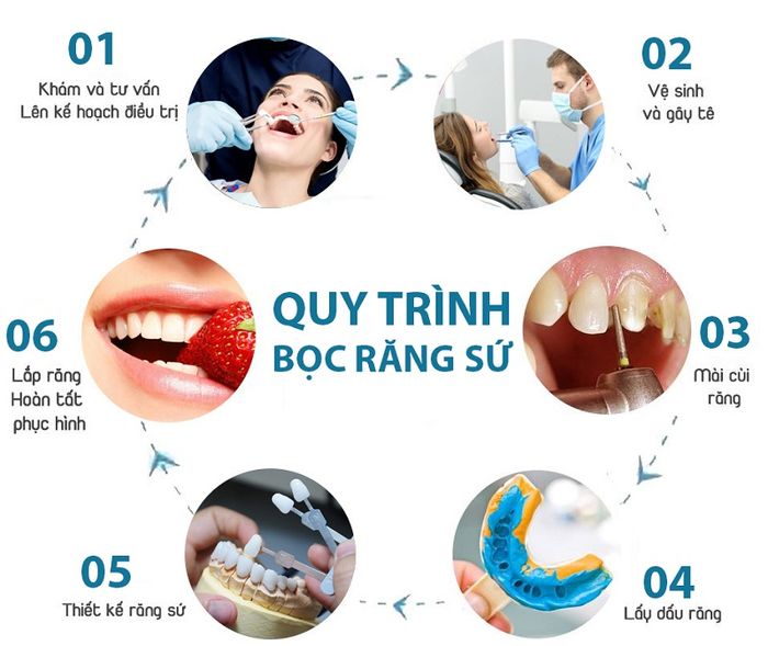 Quy trình bọc răng sứ đạt chuẩn