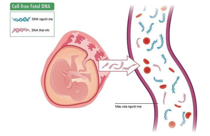 Thực hiện xét nghiệm NIPT từ tuần thai thứ 9 giúp phát hiện hội chứng Klinefelter ở thai nhi.