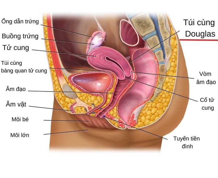 Minh họa vị trí giải phẫu của túi cùng Douglas