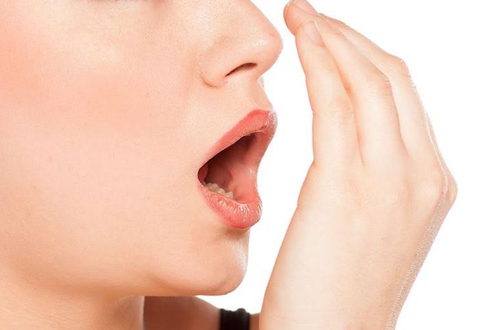 Viêm nướu hoại tử lở loét khiến người bệnh gặp vấn đề về hơi thở hôi.