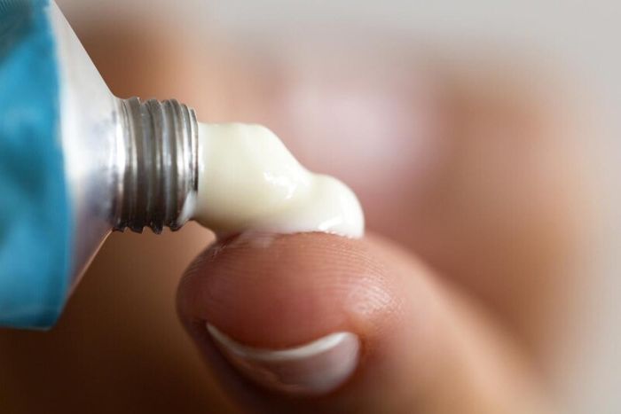 Nhiệt lưỡi có thể được điều trị bằng thuốc bôi giảm viêm đau