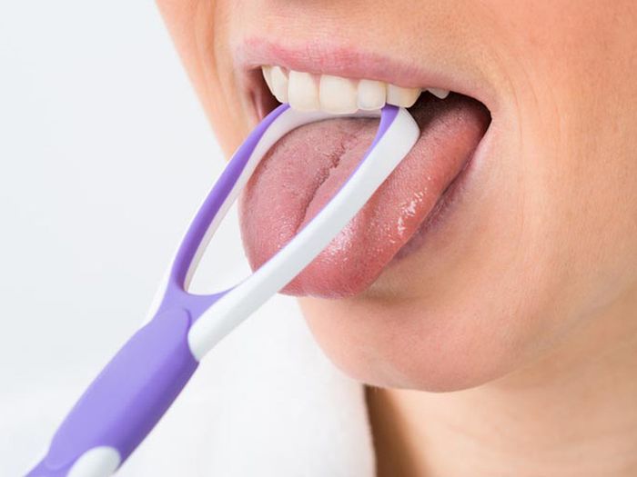 Cần vệ sinh răng miệng và lưỡi sạch sẽ để ngăn vi khuẩn xâm nhập vào vết nhiệt