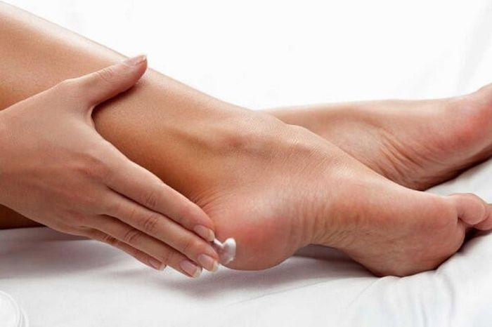 Thoa kem dưỡng ẩm là bước đầu tiên cần thực hiện khi chưa biết phải làm gì khi gót chân nứt