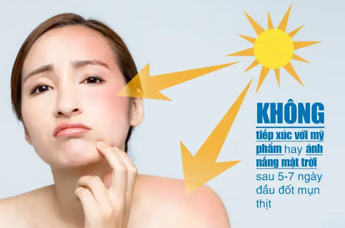 Chú ý chăm sóc da sau khi xử lý mụn thịt