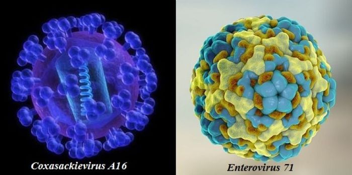 Hai nguyên nhân phổ biến gây ra bệnh tay chân miệng