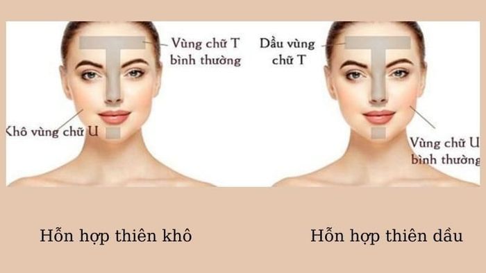 Người có làn da hỗn hợp cần phải nhận biết da thiên khô hay thiên dầu để chọn sản phẩm dưỡng ẩm phù hợp