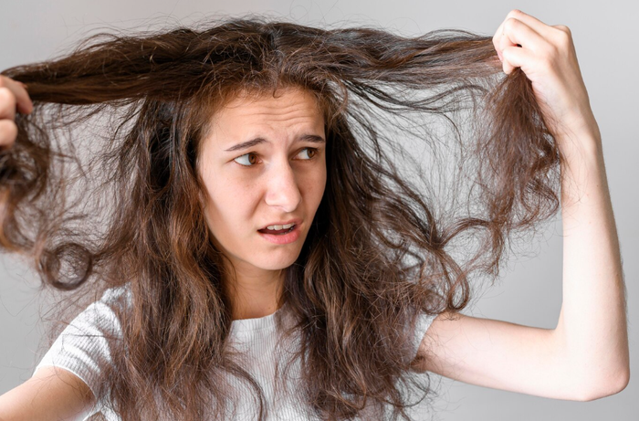 Da đầu dầu gây ra lo lắng cho nhiều người, đặc biệt là phụ nữ có mái tóc dài