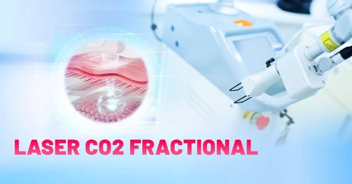 Laser CO2 Fractional sử dụng sóng 70 - 80 micromet để loại bỏ mụn thịt và đã được FDA chứng nhận về tính an toàn.