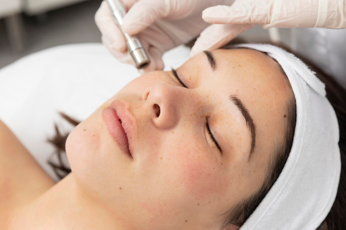Nên chọn spa đáng tin cậy để trị mụn