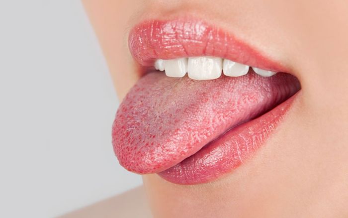 Có nhiều nguyên nhân khác nhau dẫn đến việc lưỡi nổi mụn thịt.