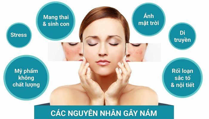 Có Thể Chữa Lành Nám Tàn Nhang Lâu Năm?