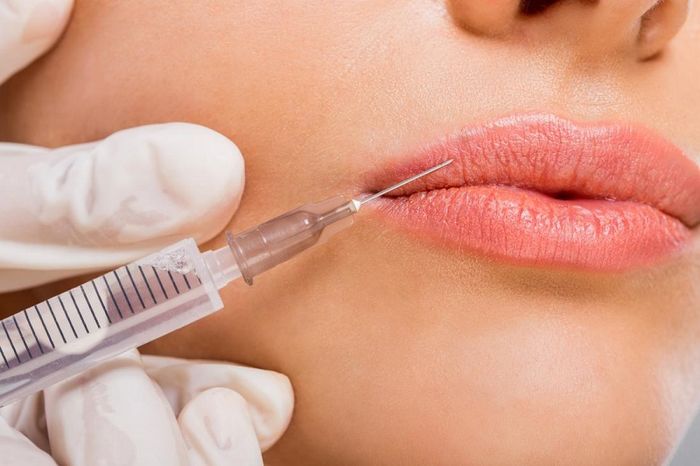 Các ứng dụng của filler mang tính đa dạng