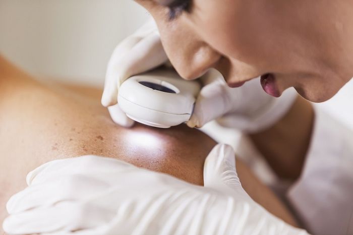 Đến khám da liễu khi có dấu hiệu bất thường trên da giúp ngăn ngừa các vấn đề về sức khỏe nghiêm trọng