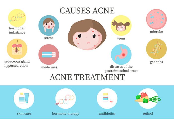 Vi khuẩn Propionibacterium Acnes gây ra sự hình thành của mụn trứng cá