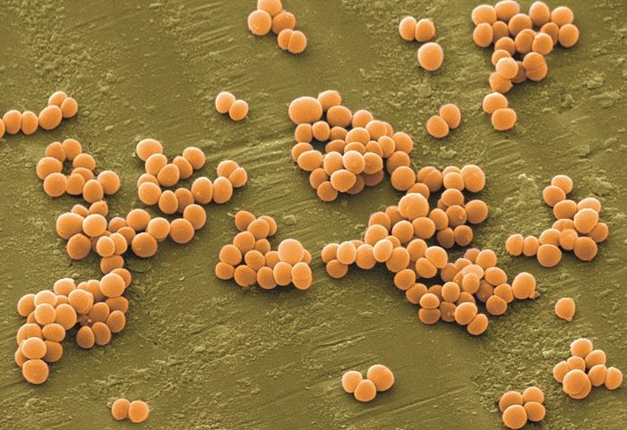 Vi khuẩn Staphylococcus là một trong những nguyên nhân gây ra bệnh