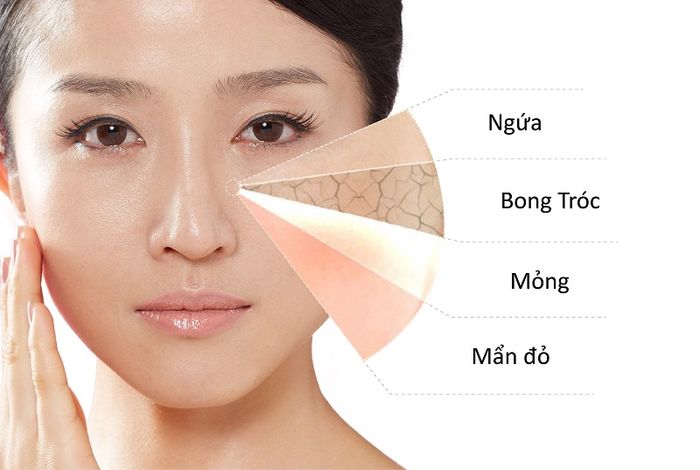 Những tác hại của việc ở trong phòng điều hòa khiến làn da phải chịu đựng